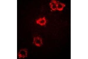 Immunofluorescent analysis of STS-1 staining in SKOV3 cells. (UBASH3B 抗体)