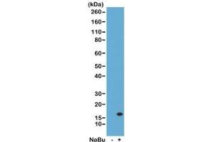 Western Blot of acid extracts from human HeLa cells untreated (-) or treated (+) with sodium butyrate using the recombinant H3K14ac antibody at 0. (Recombinant Histone 3 抗体  (acLys14))