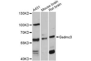 Western blot analysis of extracts of various cell lines, using GSDMC Antibody (ABIN5997854) at 1:3000 dilution. (Gasdermin C3 抗体)