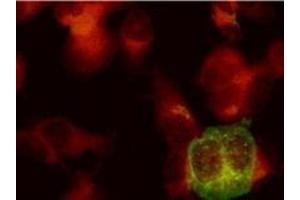 Immunofluorescence (IF) image for anti-Herpes Simplex Virus Type 2, Glycoprotein E (HSV2 gE) antibody (ABIN265568) (HSV-2 gE 抗体)