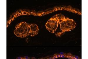 Immunofluorescence (IF) image for anti-Keratin 14 (KRT14) antibody (ABIN7258338)