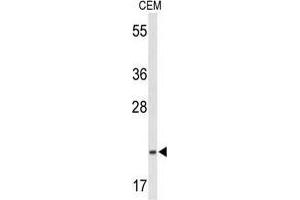 Western blot analysis of TIFA Antibody (N-term) in CEM cell line lysates (35 µg/lane).