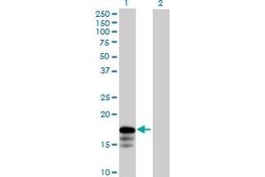 Western Blot analysis of RNF181 expression in transfected 293T cell line by RNF181 MaxPab polyclonal antibody. (RNF181 抗体  (AA 1-153))