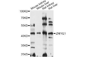 Western blot analysis of extracts of various cell lines, using ZNF621 antibody (ABIN6291114) at 1:1000 dilution. (ZNF621 抗体)