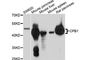 Western blot analysis of extracts of various cell lines, using CPB1 antibody (ABIN4903360) at 1:1000 dilution. (CPB1 抗体)