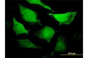 Immunofluorescence (IF) image for anti-Cell Division Cycle 45 Homolog (S. Cerevisiae) (CDC45) (AA 1-566) antibody (ABIN948673)