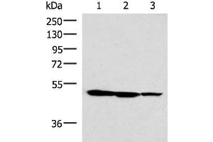 Western blot analysis of HepG2 K562 and A172 cell lysates using TTC38 Polyclonal Antibody at dilution of 1:1000 (TTC38 抗体)
