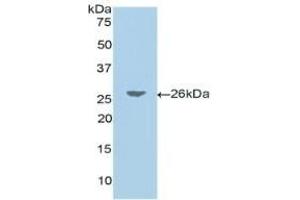 Detection of Recombinant JAG1, Human using Polyclonal Antibody to Jagged 1 (JAG1) (JAG1 抗体  (AA 33-250))