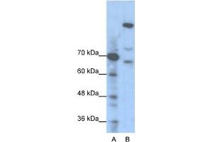 WB Suggested Anti-GLI1 Antibody Titration:  1. (GLI1 抗体  (N-Term))