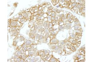 Immunohistochemistry (IHC) image for anti-IQ Motif Containing GTPase Activating Protein 1 (IQGAP1) (AA 1-50) antibody (ABIN7448978)