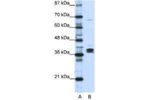 HNRPDL antibody used at 1 ug/ml to detect target protein. (HNRPDL 抗体  (Middle Region))
