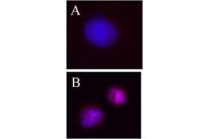 Image no. 1 for anti-Aurora Kinase B (AURKB) (pThr232) antibody (ABIN230502) (Aurora Kinase B 抗体  (pThr232))