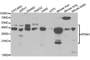 Western blot analysis of extracts of various cell lines, using EFNA1 antibody (ABIN5973078) at 1/1000 dilution. (Ephrin A1 抗体)
