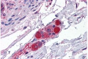 Human Small Intestine, Submucosal Plexus: Formalin-Fixed, Paraffin-Embedded (FFPE) (CDC42BPA 抗体  (AA 2-14))