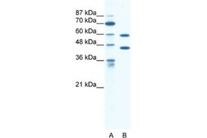 Western Blotting (WB) image for anti-Cation Channel, Sperm Associated 2 (CATSPER2) antibody (ABIN2461149) (CATSPER2 抗体)