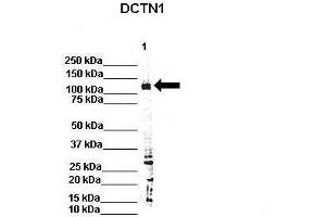 WB Suggested Anti-Dctn1 Antibody  Positive Control: Lane 1: 80ug rat brain extract Primary Antibody Dilution :  1:500 Secondary Antibody : IRDye 800 CW goat anti-rabbit from Li-COR Bioscience Secondry Antibody Dilution :  1:20,000 Submitted by: Dr. (Dynactin 1 抗体  (C-Term))