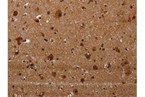 The image on the left is immunohistochemistry of paraffin-embedded Human brain tissue using ABIN7191356(MAGEE1 Antibody) at dilution 1/30, on the right is treated with synthetic peptide. (MAGEE1 抗体)
