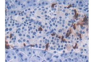 DAB staining on IHC-P; Samples: Human Pancreas Tissue (CXCL16 抗体  (AA 33-171))