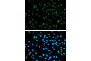 Immunofluorescence analysis of A549 cell using WHSC1L1 antibody. (WHSC1L1 抗体)