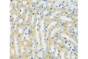 Immunohistochemistry of paraffin-embedded Mouse kidney using CAMK1 Polyclonal Antibody at dilution of 1:100 (40x lens). (CAMK1 抗体)