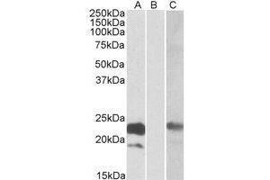 HEK293 lysate (10 µg protein in RIPA buffer) overexpressing Human CST8 with C-terminal MYC tag probed with AP21268PU-N (1ug/ml) in Lane A and probed with anti-MYC Tag (1/1000) in Lane C. (CST8 抗体  (Internal Region))