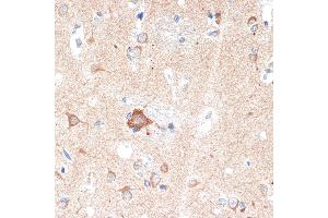 Immunohistochemistry of paraffin-embedded human brain using  Rabbit mAb (ABIN7265453) at dilution of 1:100 (40x lens).