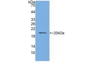 Western blot analysis of recombinant Mouse AQP4. (Aquaporin 4 抗体  (AA 177-304))