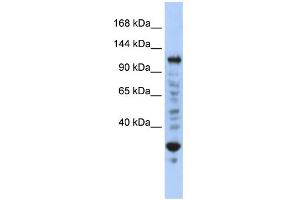WB Suggested Anti-NFX1 Antibody Titration:  0. (NFX1 抗体  (N-Term))
