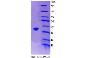 SDS-PAGE analysis of Human ICAM3 Protein. (ICAM-3/CD50 蛋白)