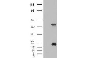 Western Blotting (WB) image for anti-Sonic Hedgehog (SHH) (AA 24-197) antibody (ABIN1491249) (Sonic Hedgehog 抗体  (AA 24-197))