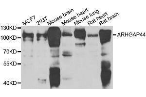 Western blot analysis of extracts of various cell lines, using ARHGAP44 antibody.