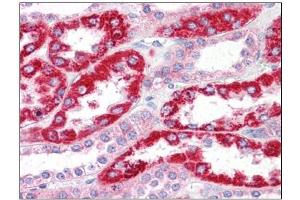 Human Kidney: Formalin-Fixed, Paraffin-Embedded (FFPE) (OCIAD2 抗体  (N-Term))