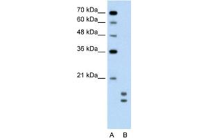 WB Suggested Anti-UBE2L3 Antibody Titration:  0. (UBE2L3 抗体  (C-Term))