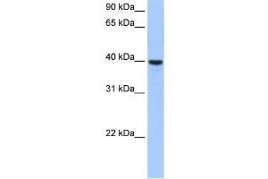 ST6GALNAC4 antibody used at 0. (ST6GALNAC4 抗体  (Middle Region))