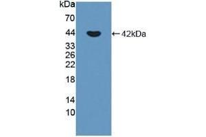 Detection of Recombinant CDHP, Human using Polyclonal Antibody to Placental Cadherin (P-cadherin) (P-Cadherin 抗体  (AA 371-660))