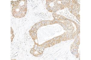 Immunohistochemistry (IHC) image for anti-Inositol 1,4,5-Trisphosphate Receptor, Type 3 (ITPR3) (AA 625-675) antibody (ABIN7454435)