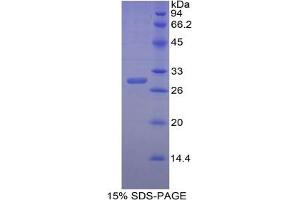 SDS-PAGE of Protein Standard from the Kit (Highly purified E. (CA2 ELISA 试剂盒)