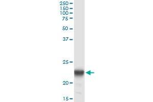 Immunoprecipitation of PMVK transfected lysate using anti-PMVK monoclonal antibody and Protein A Magnetic Bead , and immunoblotted with PMVK MaxPab rabbit polyclonal antibody. (PMVK 抗体  (AA 1-192))
