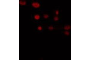 ABIN6274370 staining LOVO cells by IF/ICC. (TRIP13 抗体  (C-Term))