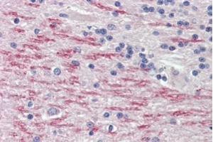 Immunohistochemistry (IHC) image for anti-Cytochrome P450, Family 26, Subfamily A, Polypeptide 1 (CYP26A1) (Internal Region) antibody (ABIN5539703)