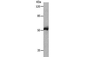Western Blot analysis of 231 cell using MMP8 Polyclonal Antibody at dilution of 1:800 (MMP8 抗体)