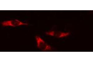 ABIN6274191 staining HeLa cells by IF/ICC. (Hexokinase 1 抗体  (N-Term))