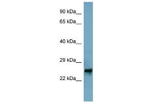 WB Suggested Anti-MRPL48 Antibody Titration: 0. (MRPL48 抗体  (Middle Region))