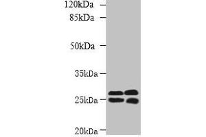 Western blot All lanes: CMBL antibody at 1 μg/mL Lane 1: Mouse kidney tissue Lane 2: Mouse liver tissue Secondary Goat polyclonal to rabbit IgG at 1/10000 dilution Predicted band size: 29 kDa Observed band size: 29, 25 kDa (CMBL 抗体  (AA 2-245))