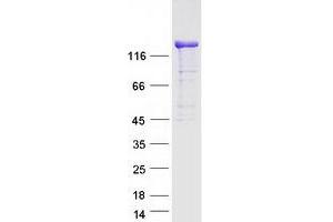 Validation with Western Blot