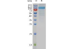 Human B7-H7 Protein, hFc Tag on SDS-PAGE under reducing condition.