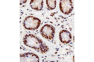 Immunohistochemical analysis of paraffin-embedded H. (RBX1 抗体  (C-Term))