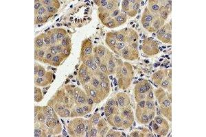 Immunohistochemical analysis of TECR staining in human liver formalin fixed paraffin embedded tissue section. (TECR 抗体  (C-Term))