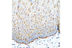 Immunohistochemistry of paraffin-embedded human esophagus using MT-CO2 antibody (ABIN5997496) at dilution of 1/100 (40x lens). (COX2 抗体)