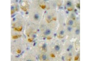 Used in DAB staining on fromalin fixed paraffin-embedded Liver tissue (CD86 抗体  (AA 37-272))